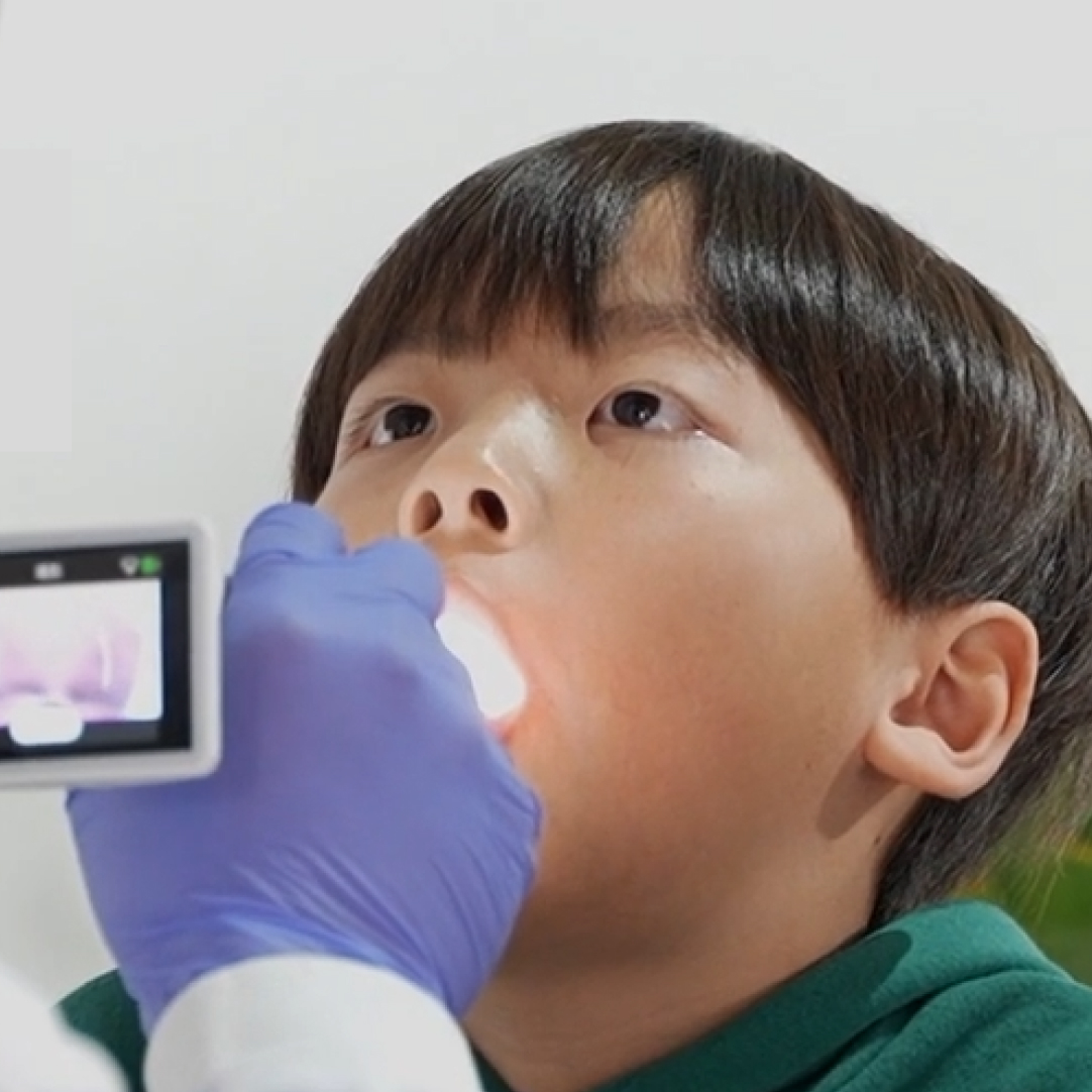 鼻に綿棒をいれないインフルエンザ検査