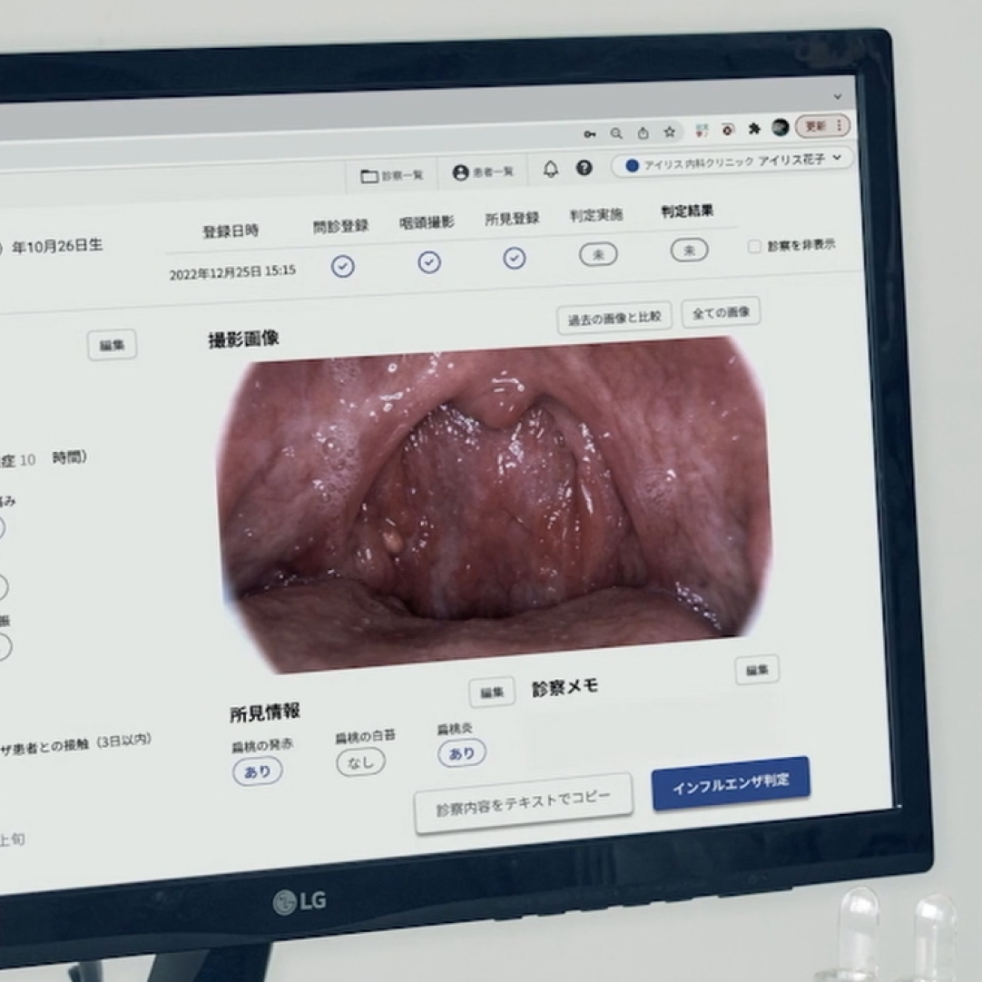 鼻に綿棒をいれないインフルエンザ検査